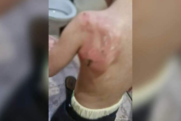 В Павловске воспитательницу обвинили в издевательствах над детсадовцем