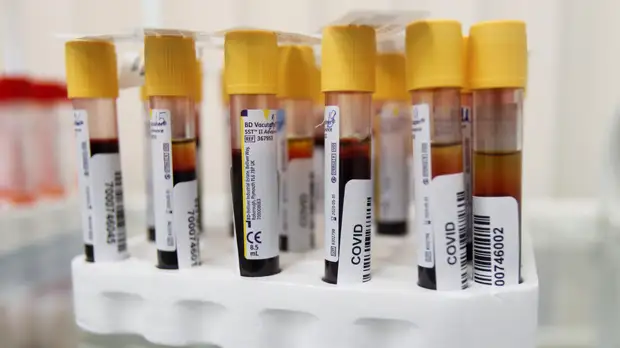 В Самарской области подтвердили 705 случаев COVID-19 за сутки