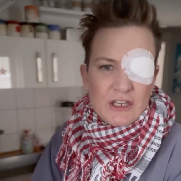 Телеведущая лишилась глаза во время празднования Нового года