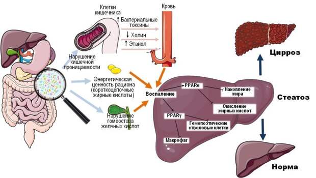 Механизм влияния дисбиотических изменений кишечной микробиоты на патогенез и прогрессирование ожирения печени. Источник изображения: ФИЦ питания и биотехнологии