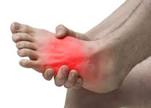 Жжения в стопах (синдром Гопалана): что это, к какому врачу обращаться?