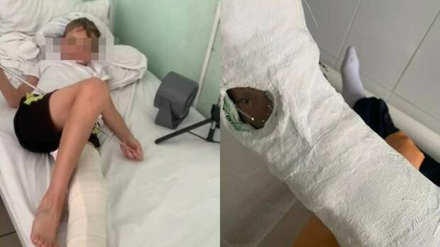 Родители мальчика, которого переехал автомобиль в Барнауле, обратились к Бастрыкину