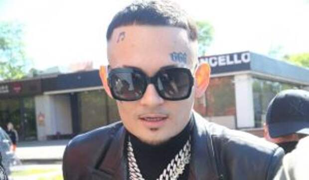 Больной Моргенштерн не может нормально передвигаться