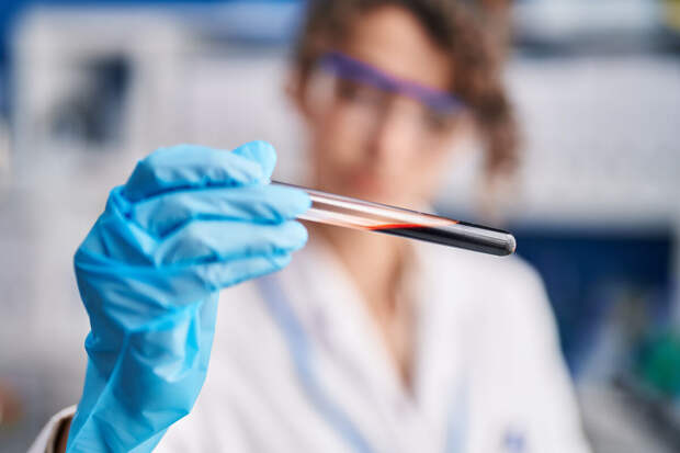 AFM: создан биосенсор для точного анализа крови на болезнь Альцгеймера