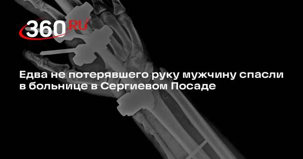 Едва не потерявшего руку мужчину спасли в больнице в Сергиевом Посаде
