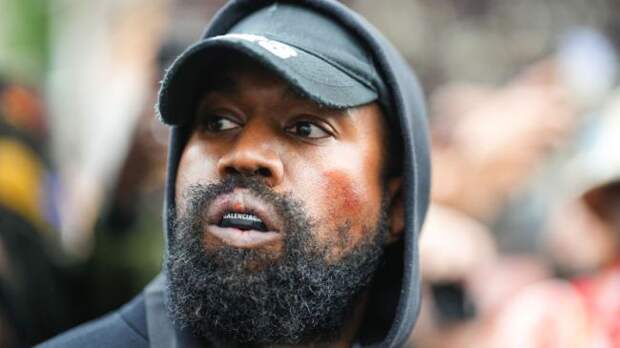 Stephen A. Smith Declares Kanye West Is 'Off His Rocker'