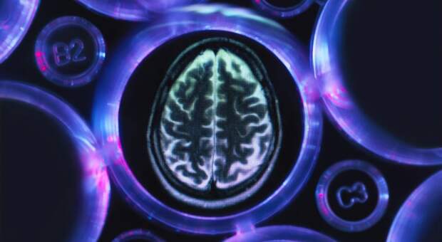 7 распространенных болезней, которые повышают риск развития синдрома Альцгеймера