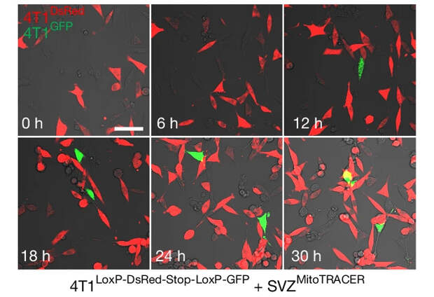 Рис. 3. Конфокальная микроскопия совместной культуры нейронов SVZ и клеток 4T1