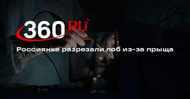 Девушке в Архангельской области разрезали лоб после неудачно выдавленного прыща