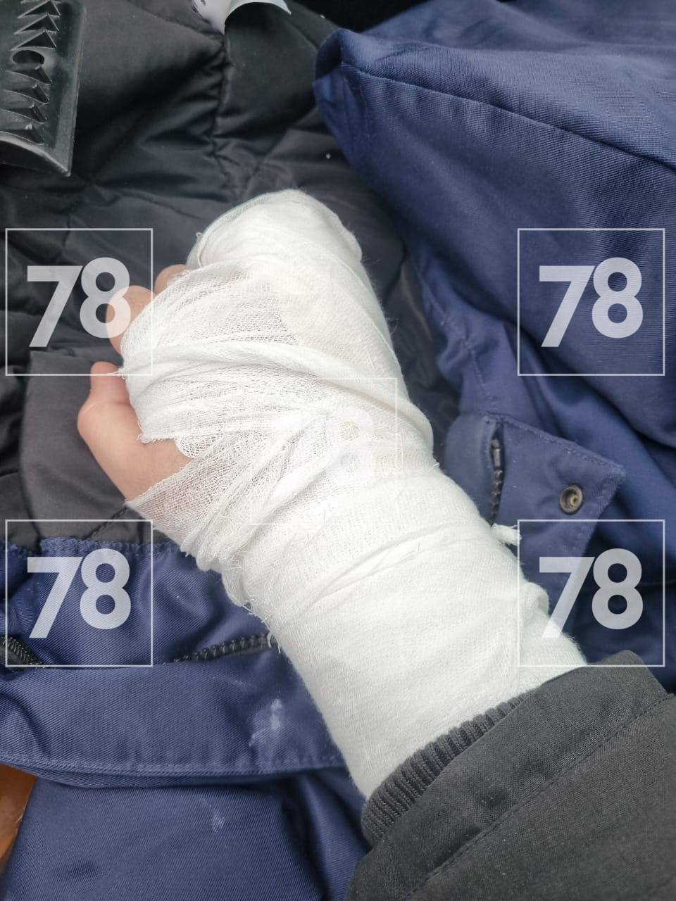 Инцидент произошел в ночь на 3 февраля в СПб ГБУЗ «Городская больница № 26». Как передаёт 78.ру, пациент и врач общались за сутки дважды. После первого посещения больной был выписан домой, однако спустя время вернулся в медучреждение в нетрезвом виде с металлической лопатой для снега и нанес медику несколько ударов. В результате нападения врачу диагностировали закрытую черепно-мозговую травму и закрытый перелом правой кисти.