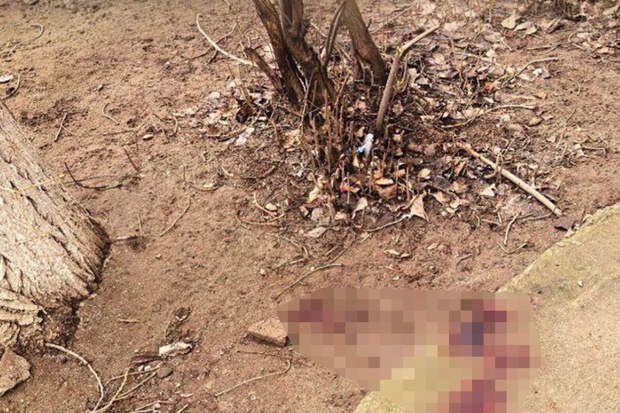 В Волгограде врачи борются за жизнь девочки, выпавшей из окна четвертого этажа