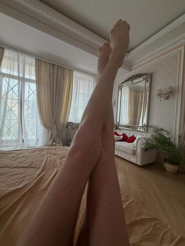 Анастасия Волочкова показала ноги после операции: «Процесс восстановления»