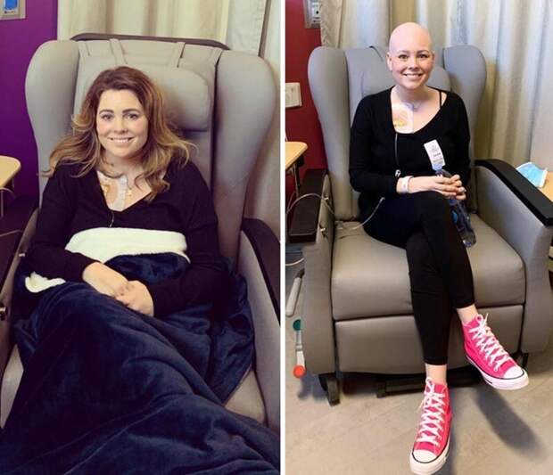 Первый день химиотерапии и последний день химиотерапии