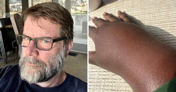 12 интересных случаев, когда с телом людей случилось что-то странное