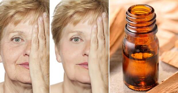 sandalwood-essential-oil-10-health-uses