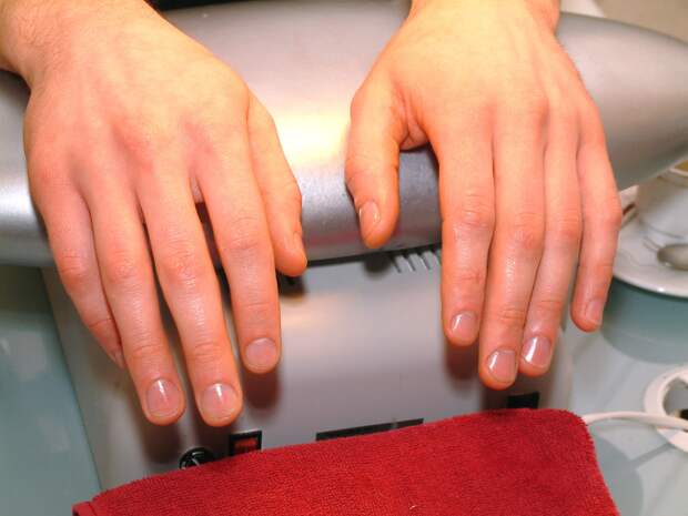 Цветные полосы на ногтях связали с редким раковым синдромом