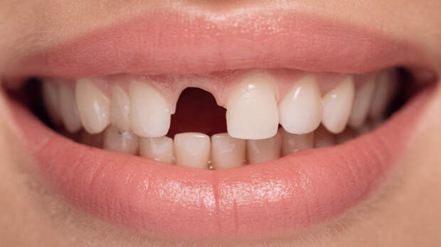 Сон о выпадающих зубах: что подсознание пытается вам сказать