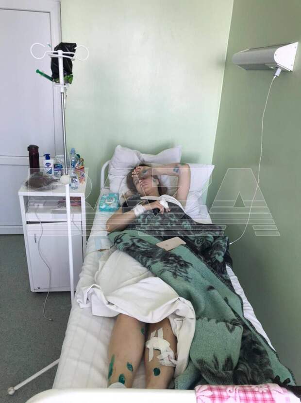 Напомним, во время атаки на Курскую область ВСУ ударили по бригаде скорой помощи дроном. Фельдшер Александр Чекалин и водитель Александр Никитичев погибли. Сообщалось, что пострадала врач — ее госпитализировали в тяжелом состоянии. Теперь СМИ уточняют, что ранена была Дарья Коннова.