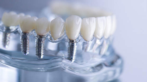 Стоматология на кухне: опасные товары для лечения зубов заполонили маркетплейсы