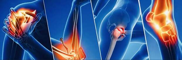 Болезни суставов, симптомы и их лечение 