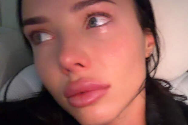 Модель Анастасия Решетова рассказала, что у нее случился нервный срыв