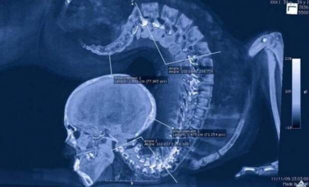 15 очень странных и страшных фото реально существующих вещей