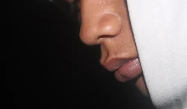 Нижегородец проковырял дырку в носу