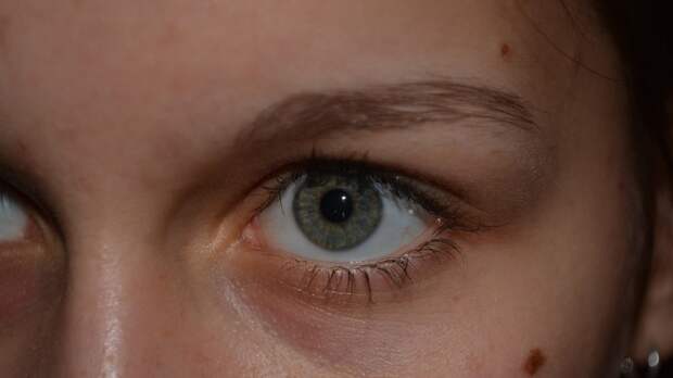 Онколог Добрецова рассказала о способах выявления меланомы на ранних стадиях