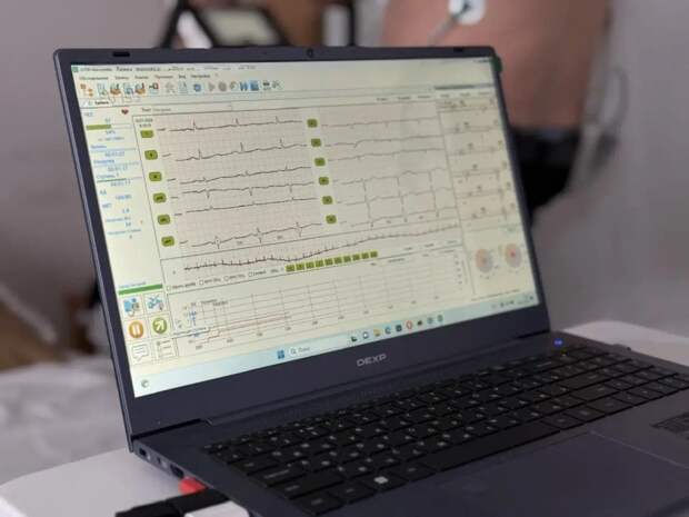 В Кошехабльской ЦРБ можно сделать стресс‑эхокардиографию