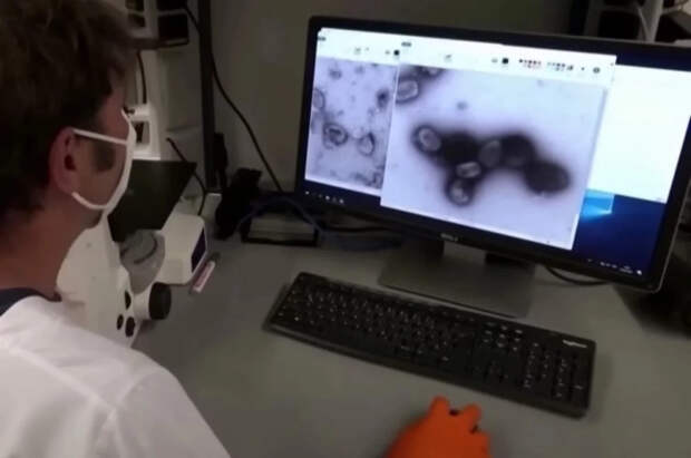 Врач Рублева заявила, что слабость может быть симптомом оспы обезьян