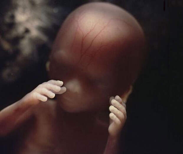 Уникальные снимки: рождение новой жизни