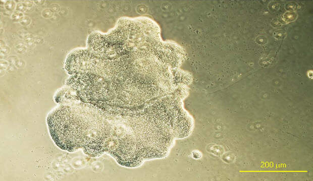 Трихоплакс (Trichoplax adhaerens)