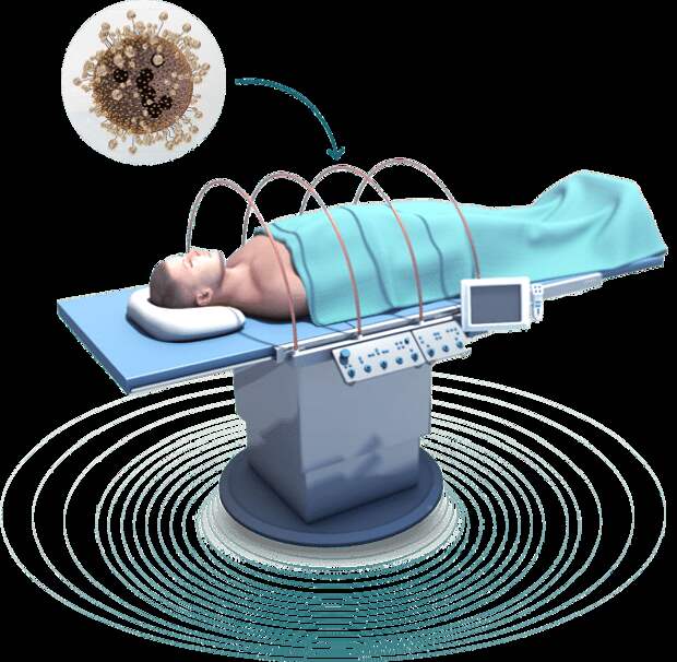 Рак станет хроническим? Израильский стартап нашел способ "сжечь" опухоль и не навредить организму