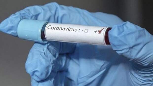 Оперативный штаб обновил данные по заболеваемости коронавирусом в КБР