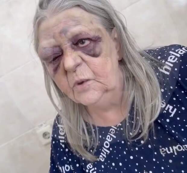 Врачей из Мариинска обвинили в избиении 76-летней пациентки с инфарктом