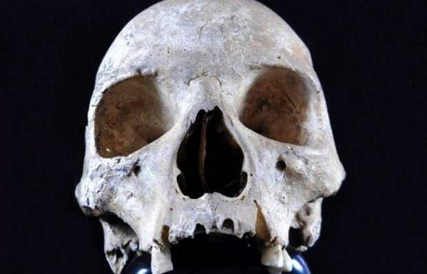Древняя торговля: череп женщины из Хоксна.