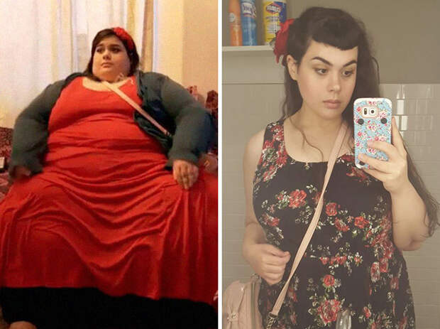 Amber Rachdi Was 660 Lbs, She Dropped To 236 Pounds