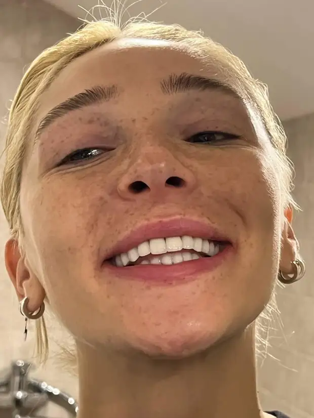 Бородина, Собчак, Решетова и другие звезды, показавшие себя без макияжа этой весной