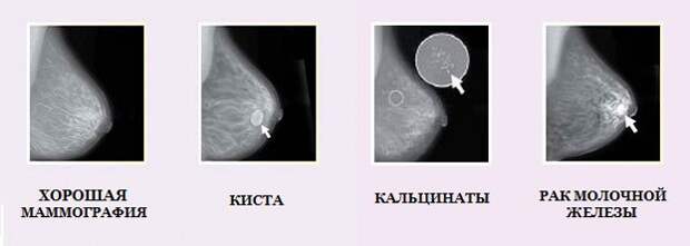 Фото иллюстративное