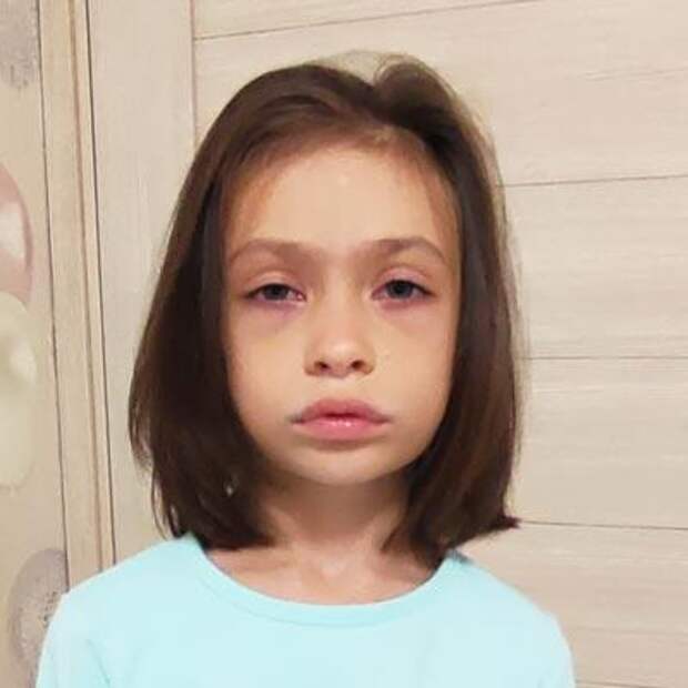 Даша Полковниченко, 8 лет, детский церебральный паралич, задержка развития, требуется лечение, 169 479 ₽
