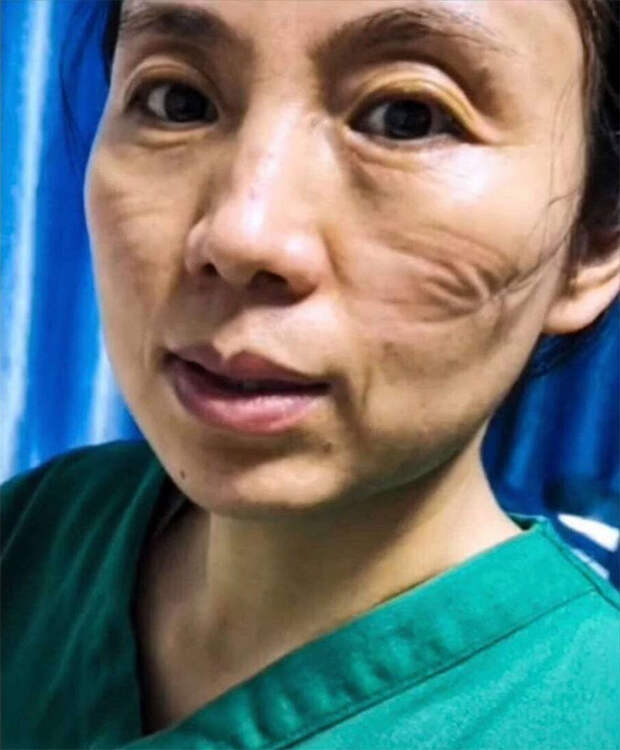 Лица медсестёр из Китая, которые борются с коронавирусом сутками напролёт