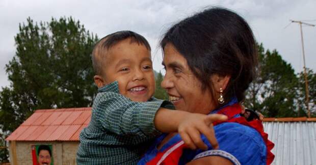Мексиканка стала сенсацией, сделав себе кесарево сечение кухонным ножом