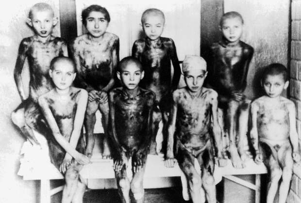 Дети — жертвы нацистских медицинских экспериментов в концлагере Аушвиц (Освенцим), Польша