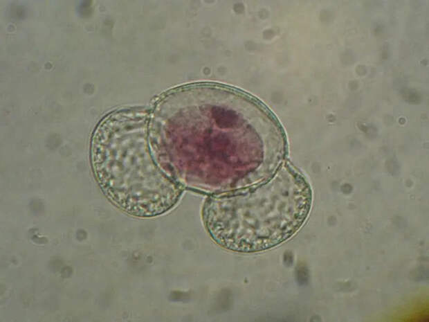 Сибирские ели в Мурманске в прямом смысле кричат... пыльцой