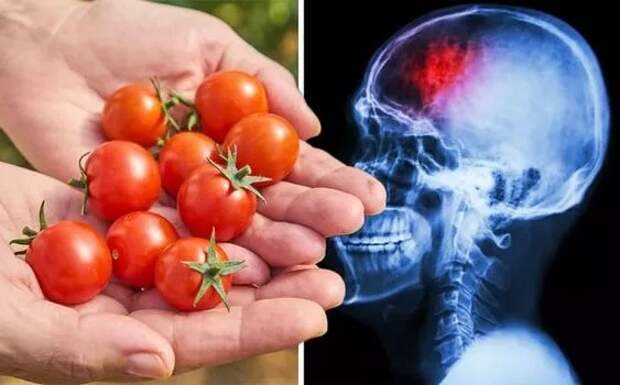 Значительно снизить риск инсульта помогут обычные помидоры