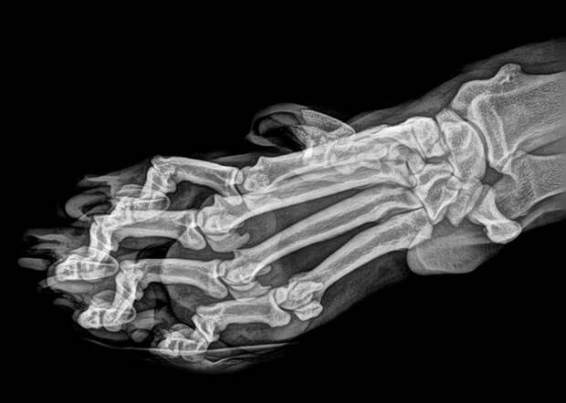 рентгены животных, рентгеновские снимки животных, фотографии рентгена животных, рентген животных зоопарка