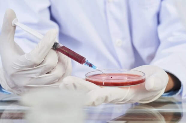 Пещера смерти: вирусолог раскрыл опасность лихорадки с кровью из глаз в РФ