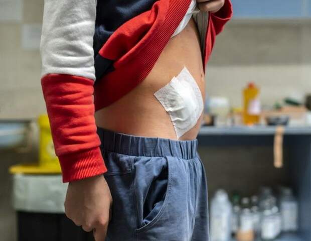 Симптомы аппендицита и его причины