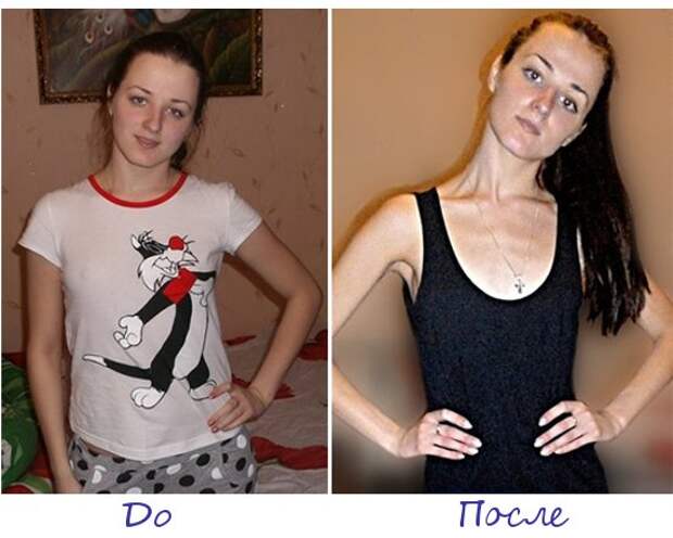 Ангелина Шмидова, Могилев (Беларусь) фото до и после похудения