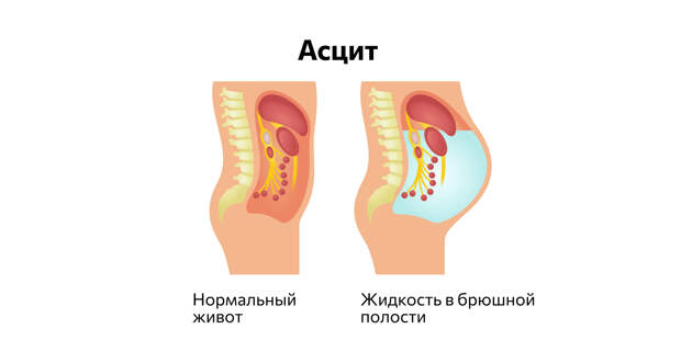 Форма живота при асците